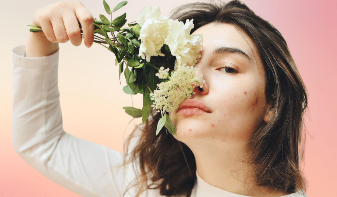 Woman with mild acne holds flowers to nose