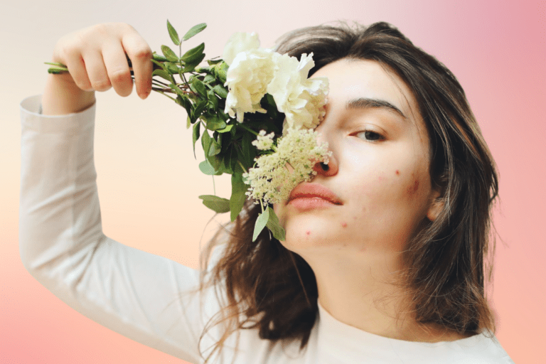 Woman with mild acne holds flowers to nose