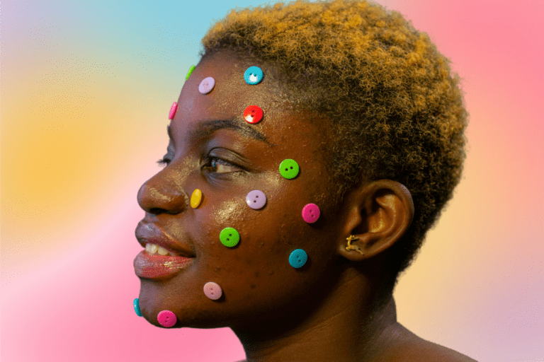 Woman with acne and colorful buttons on her face