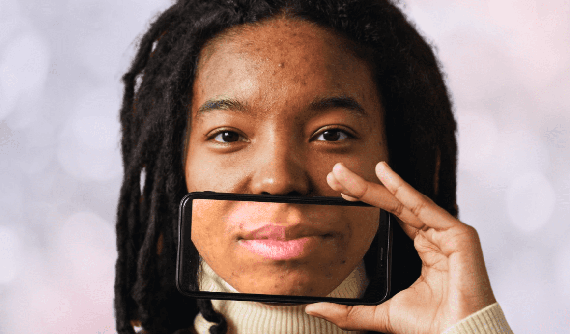 Woman with acne holds up phone in front of her face with an image of her mouth on the screen