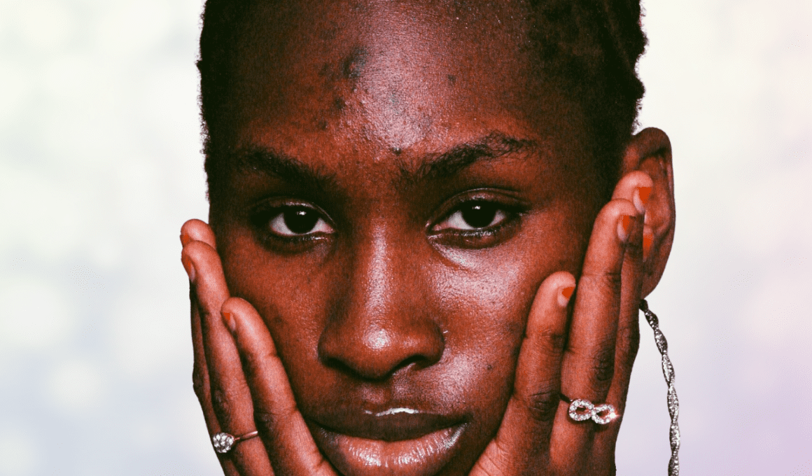 Woman with dark spots of hyperpigmentation on forehead