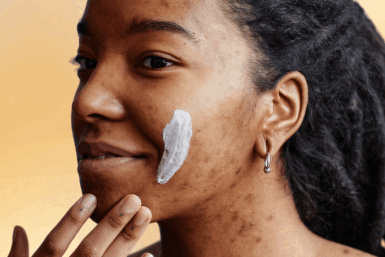 Woman with hyperpigmentation from acne applies swipe of cream to her cheek
