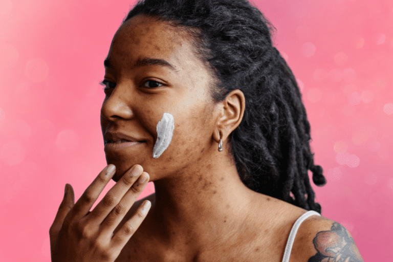 Woman with hyperpigmentation from acne applies swipe of cream to her cheek