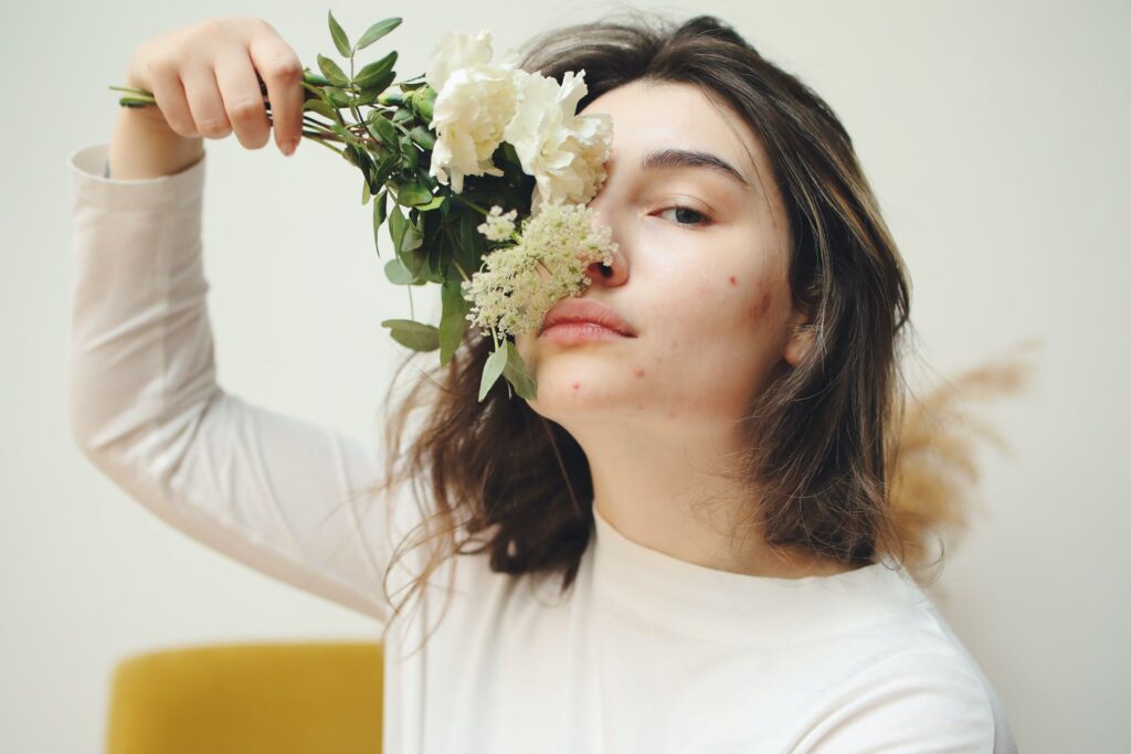 A woman with some acne marks holds flowers on her face