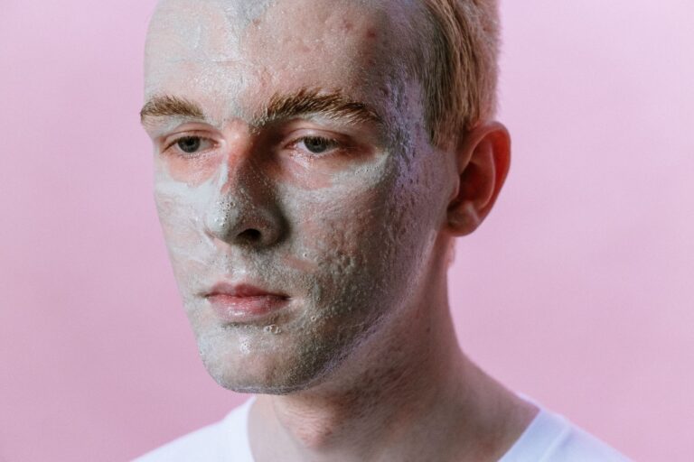 Man with acne scars doing a green face mask