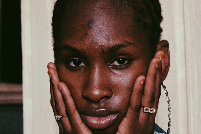 A women with post-inflammatory hyperpigmentation from acne on her forehead holds her chin in her hands