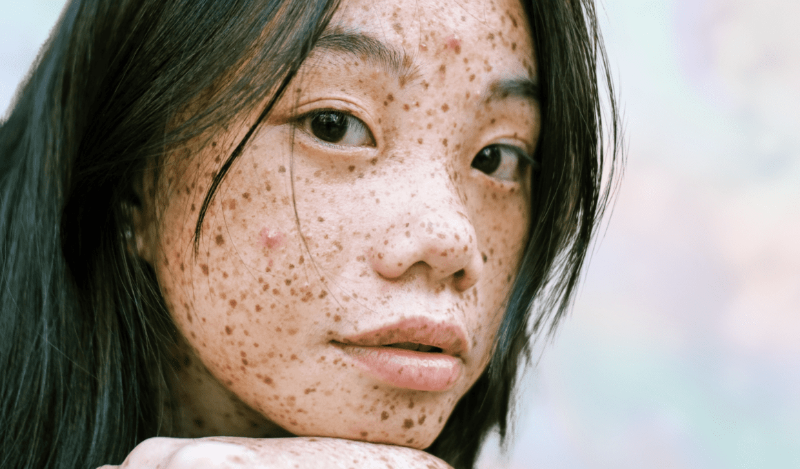 Woman with freckles and a couple of pimples looks at camera