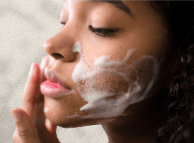 Woman with mild acne washes face with foaming face wash