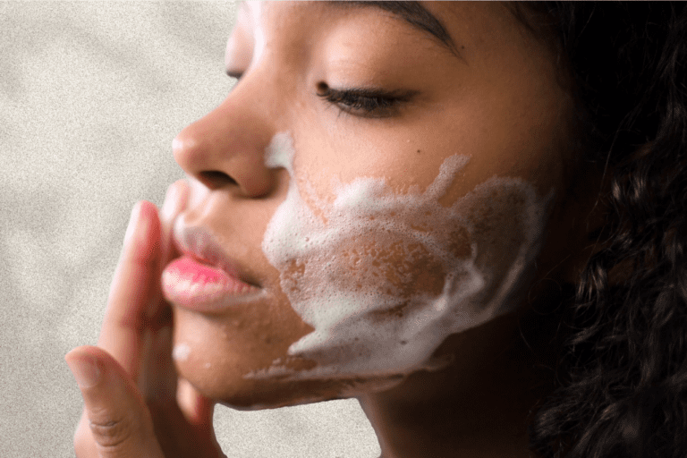 Woman with mild acne washes face with foaming face wash