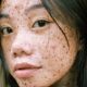 Young woman with many freckles and two pimples looks at camera