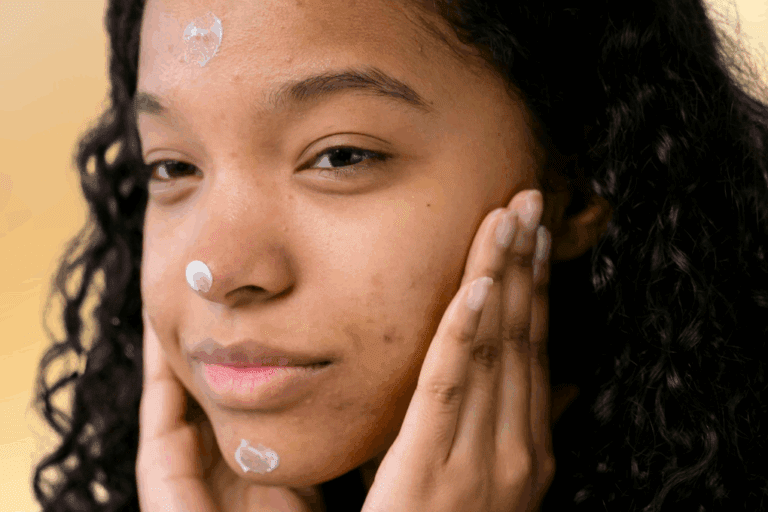 Woman with acne applying face cream