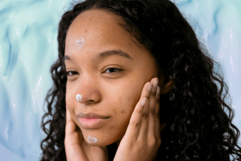 Woman with acne applying face cream