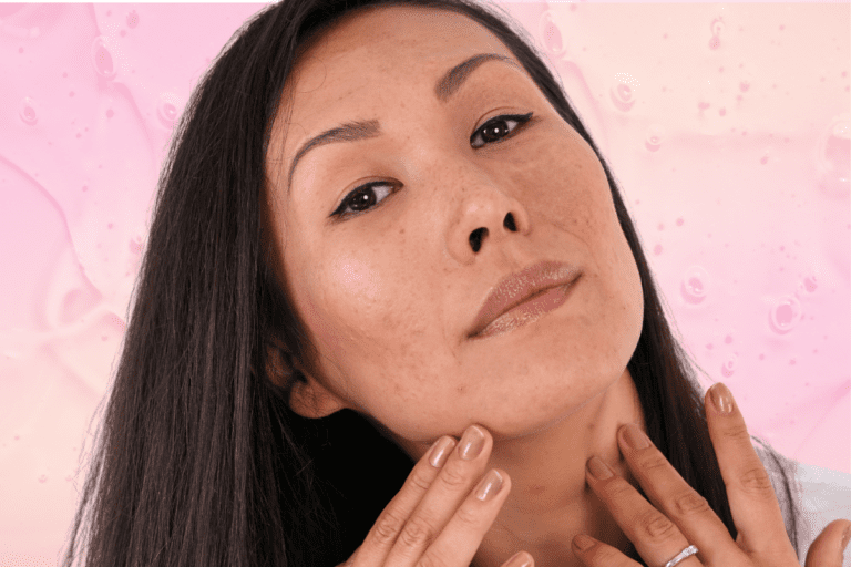 Woman with mild acne in front of pink background