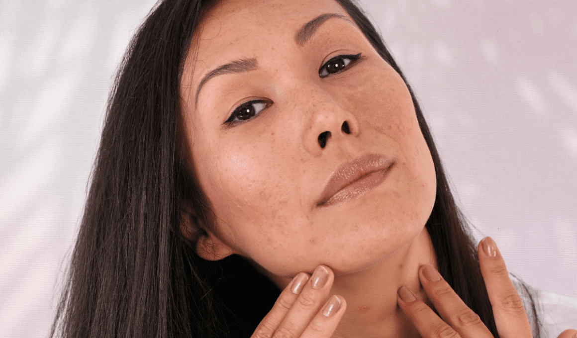 Woman with mild acne touching jawline