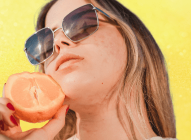 Woman with acne holding half an orange to her face