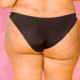 Picture of woman's butt in black underwear with some hyperpigmentation from pimples