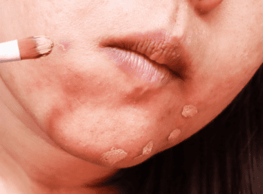 Close up of woman using makeup brush to apply concealer to blemishes on chin