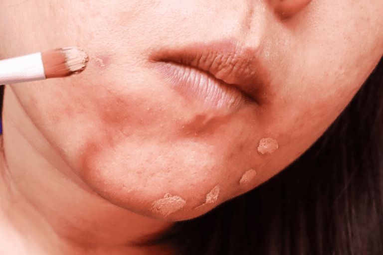 Close up of woman using makeup brush to apply concealer to blemishes on chin