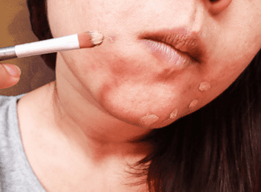 Woman applying concealer to pimples